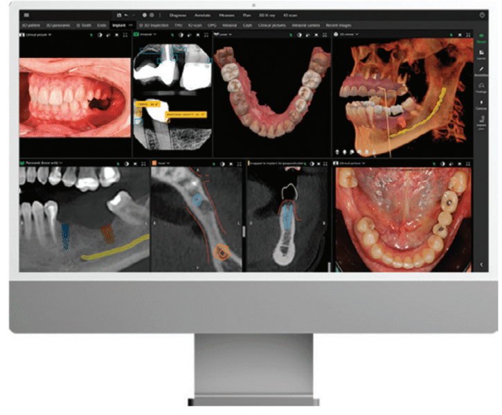 DEXIS is a renowned leader in dental imaging because of its ecosystem of products. 